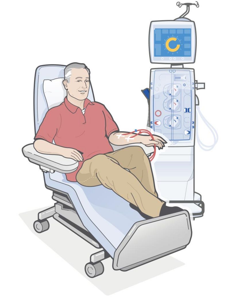 Patient receiving Hemodialysis treatment
